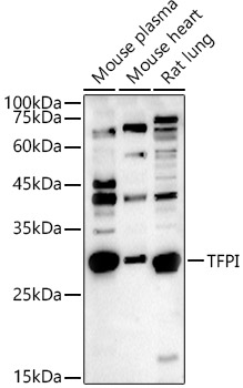 Western blot analysis of extracts of various cell lines using TFPI Polyclonal Antibody at 1:1000 dilution.