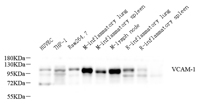 Western Blot analysis of various samples using VCAM1 Polyclonal Antibody at dilution of 1:600.