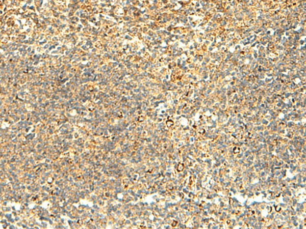 Immunohistochemistry of paraffin-embedded Human tonsil tissue  using NAPRT Polyclonal Antibody at dilution of 1:50(?200)