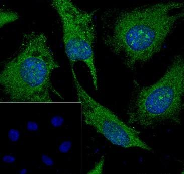 Recombinant ALDH7A1 Monoclonal Antibody - small - 6