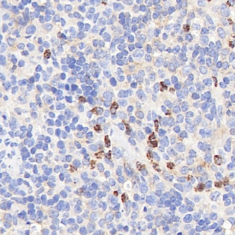 Immunohistochemistry analysis of paraffin-embedded mouse spleen  using CYBB Polyclonal Antibody at dilution of 1:400.