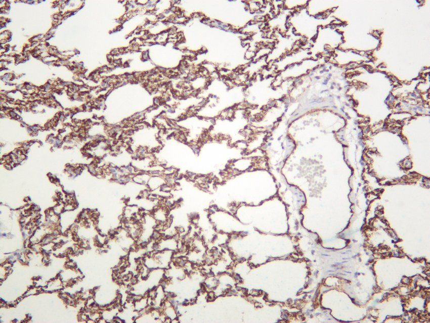 Recombinant CD31 Monoclonal Antibody - small - 5