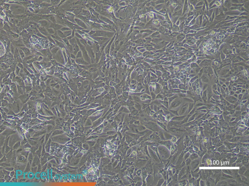 Mouse Ovarian Fibroblast Complete Medium - 1