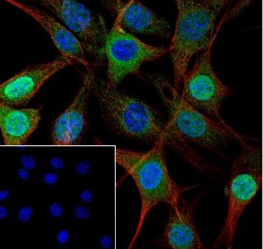 Recombinant IKK gamma Monoclonal Antibody - small - 3