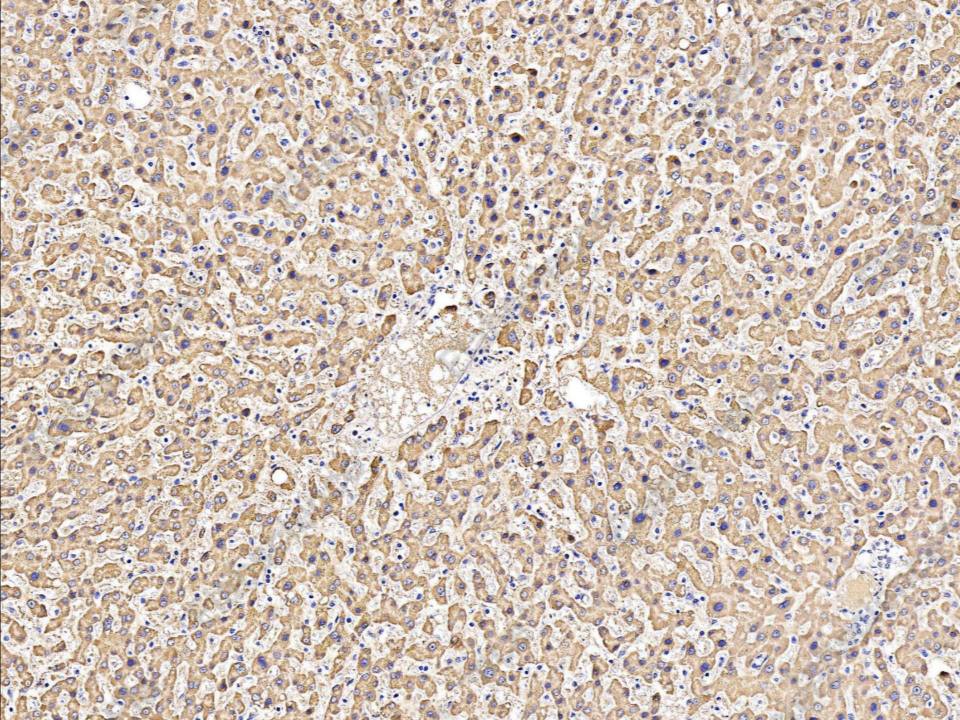 Recombinant ALDH7A1 Monoclonal Antibody - 1