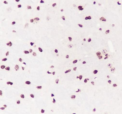 Recombinant SP1 Monoclonal Antibody - small - 4