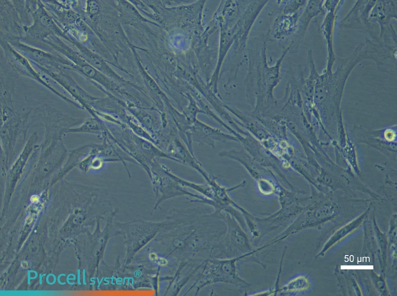 Mouse Pancreatic Stellate Cell Complete Medium - small - 5