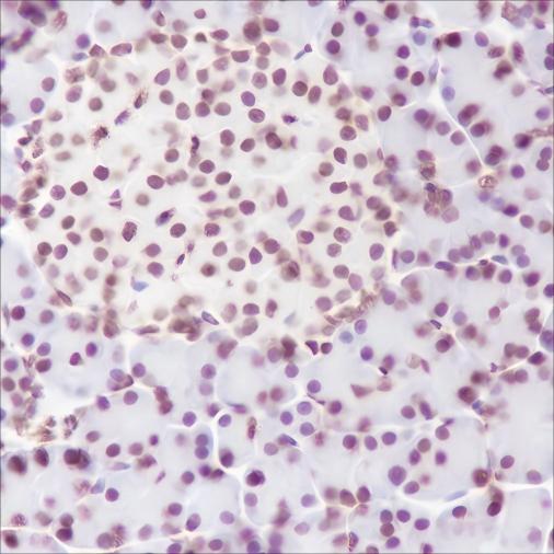 Recombinant Phospho-Cyclin D1 (Thr286) Monoclonal Antibody - small - 5