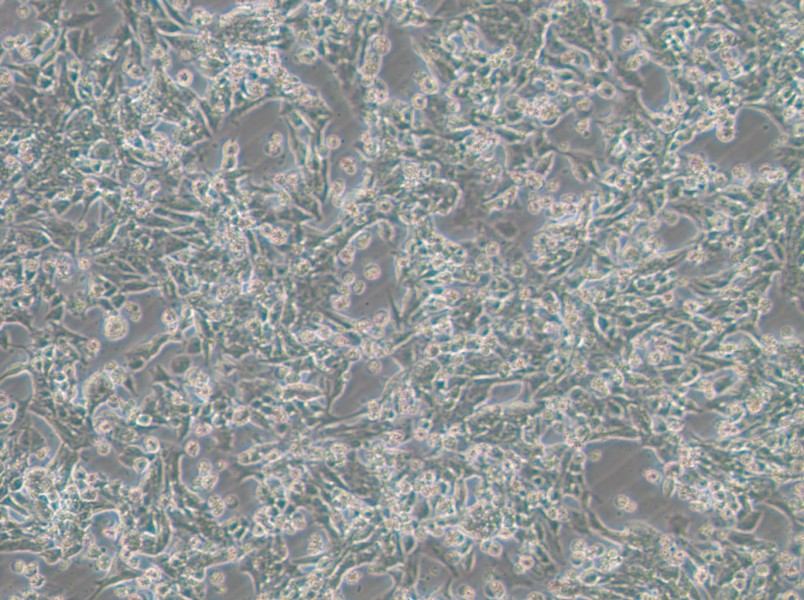 SNU-398 Cell Complete Medium - 3