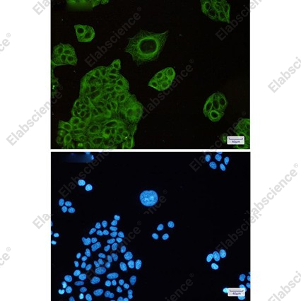 Recombinant beta IV Tubulin Monoclonal Antibody - 4