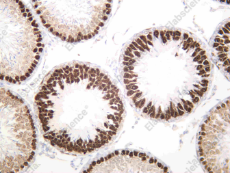 Recombinant PBK Monoclonal Antibody - 3