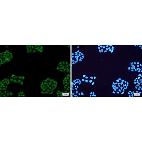 Immunofluorescence of NR1D1(green) in Hela cells using NR1D1 Rabbit mAb at dilution 1:50, and DAPI(blue)