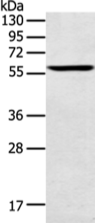 Western Blot analysis of Human testis tissue using SPATA6 Polyclonal Antibody at dilution of 1:1000