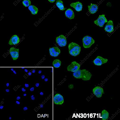 Recombinant TCL1 Monoclonal Antibody - 6