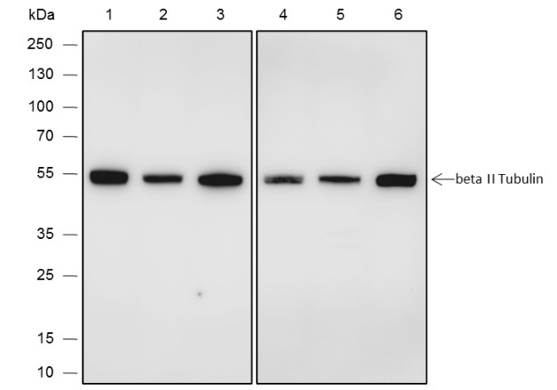 Recombinant beta II Tubulin Monoclonal Antibody-searchlist-1