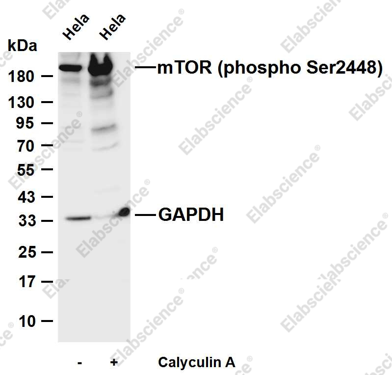 Recombinant Phospho-mTOR (Ser2448) Monoclonal Antibody - 3