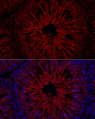 Immunofluorescence analysis of Rat testis cells using GPX4 Polyclonal Antibody at dilution of 1:200 (40x lens). Blue: DAPI for nuclear staining.