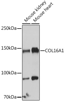 Western blot analysis of extracts of various cell lines using COL16A1 Polyclonal Antibody at 1:1000 dilution.