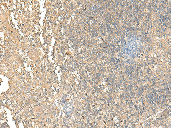 Immunohistochemistry of paraffin-embedded Human tonsil tissue  using NARS Polyclonal Antibody at dilution of 1:55(?200)