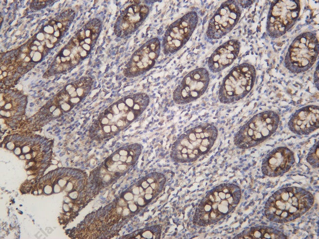 Recombinant PRX III Monoclonal Antibody - 1