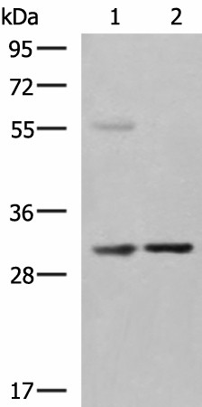 Western blot analysis of Human fetal liver tissue Jurkat cell lysates  using KHK Polyclonal Antibody at dilution of 1:550