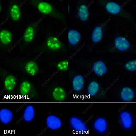 Recombinant SF3B3 Monoclonal Antibody - 3