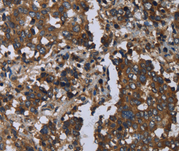 GOLGA2 Polyclonal Antibody - 3