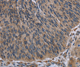 AVEN Polyclonal Antibody - 2