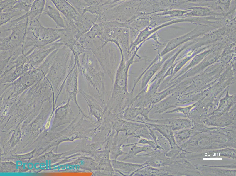 Human Corneal Stromal Cell Complete Medium - 6