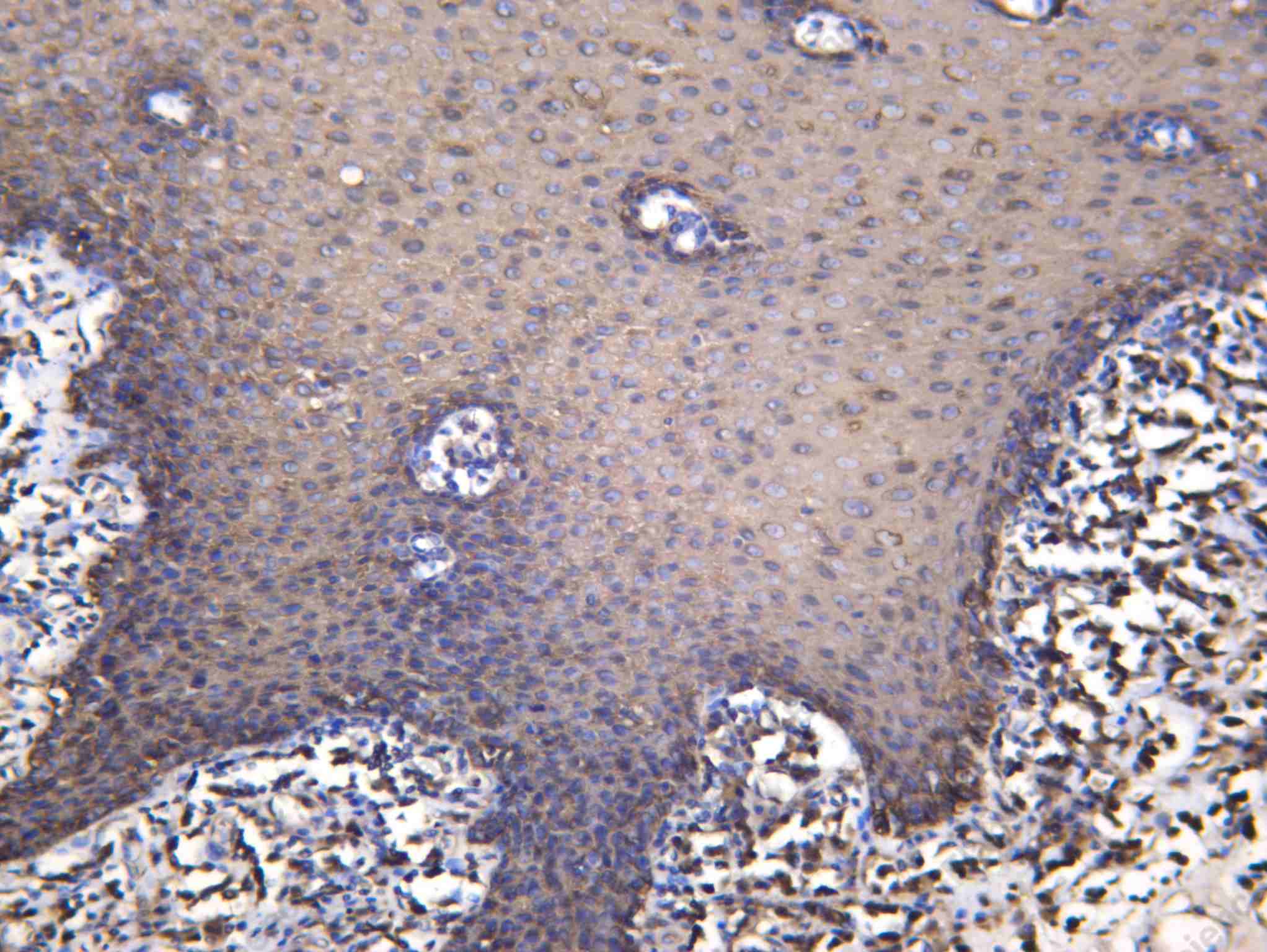 Recombinant Keratin 4 Monoclonal Antibody - 2