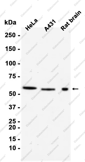 Recombinant SMARCD1 Monoclonal Antibody - 1