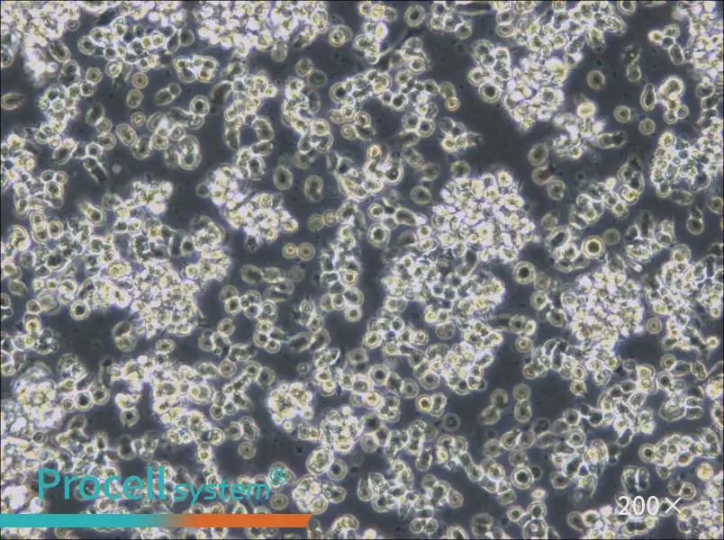 HCC38 BL Cell Complete Medium - 6