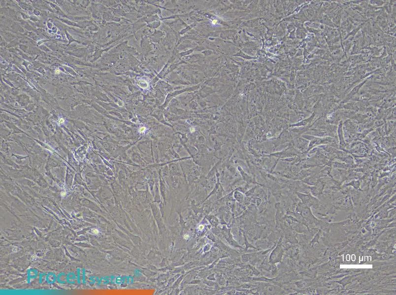 Mouse Meningeal Cell Complete Medium - 2