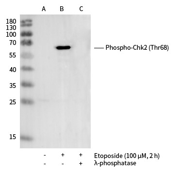 Recombinant Phospho-Chk2 (Thr68) Monoclonal Antibody - small - 3