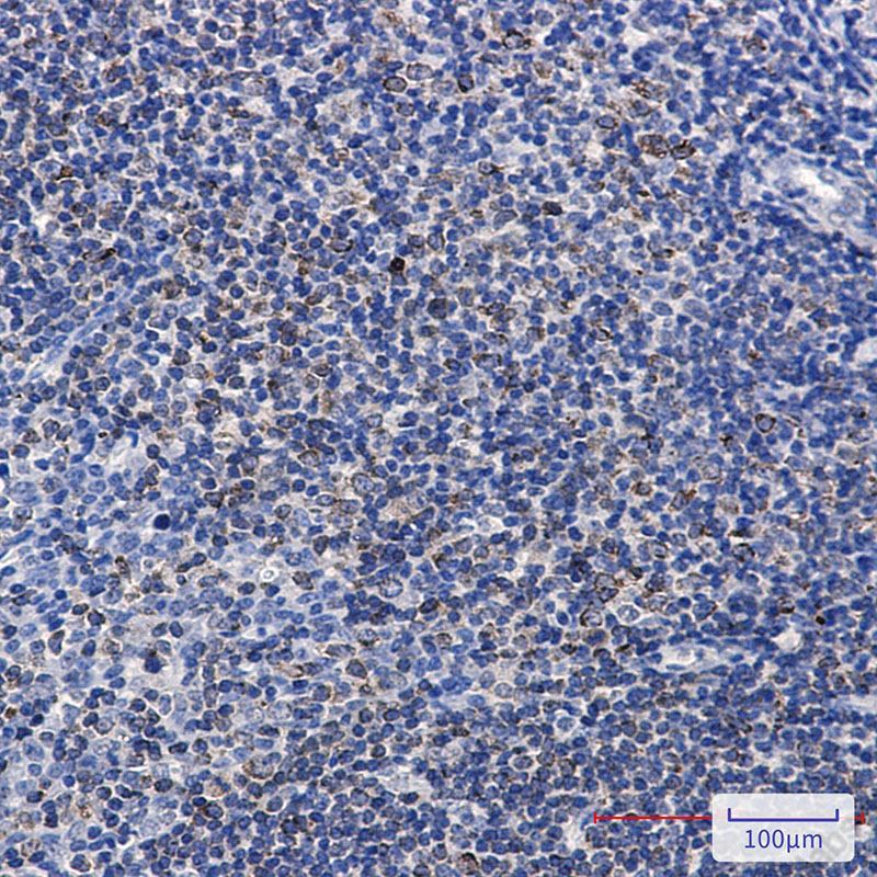 Recombinant Phospho-PTP1B (Ser378) Monoclonal Antibody - 2