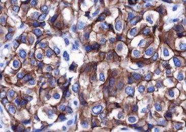Recombinant Non-Phospho (Active) β-Catenin (Ser33, Ser37, Thr41) Monoclonal Antibody-searchlist-2