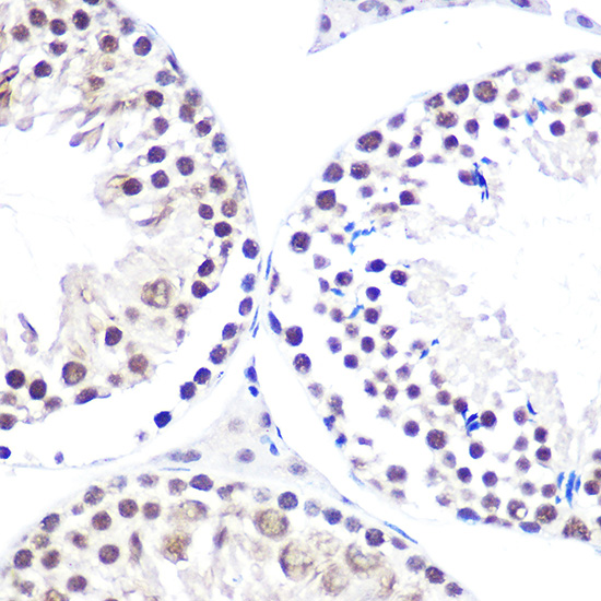 Immunohistochemistry of paraffin-embedded mouse testis using NELFE Polyclonal antibody at dilution of 1:100 (40x lens).Perform high pressure antigen retrieval with 10 mM citrate buffer pH 6.0 before commencing with IHC staining protocol.