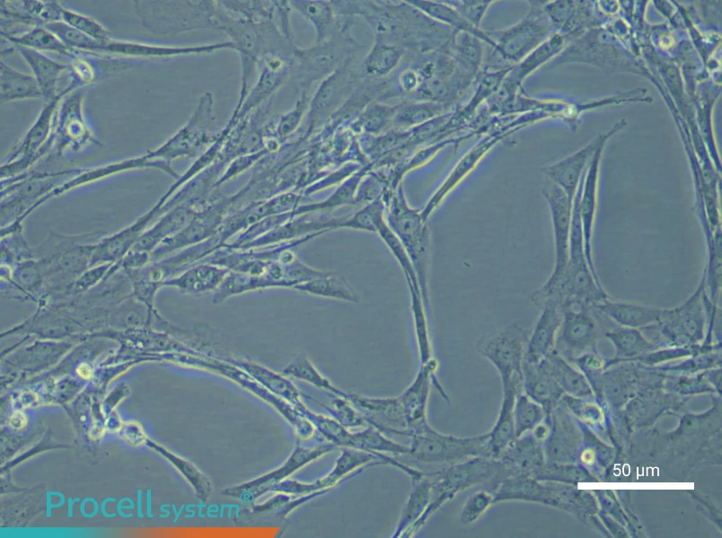 Rat Pulmonary Artery Smooth Muscle Cell Complete Medium - 4