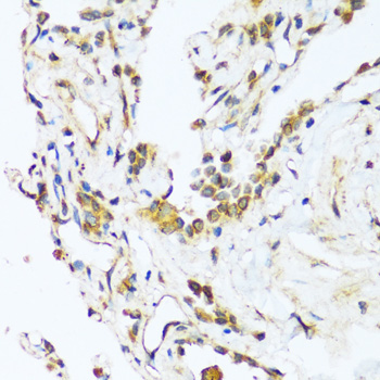 Immunohistochemistry of paraffin-embedded Human lung using BAG3 Polyclonal Antibody at dilution of  1:100 (40x lens).