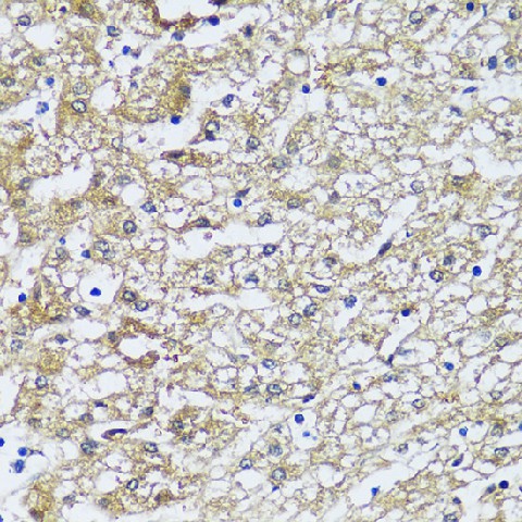 Immunohistochemistry of paraffin-embedded Human liver using NQO2 Polyclonal Antibody at dilution of 1:100 (40x lens).