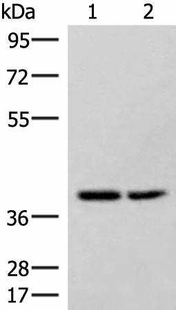 Western blot analysis of Hela and 231 cell lysates  using HPDL Polyclonal Antibody at dilution of 1:400