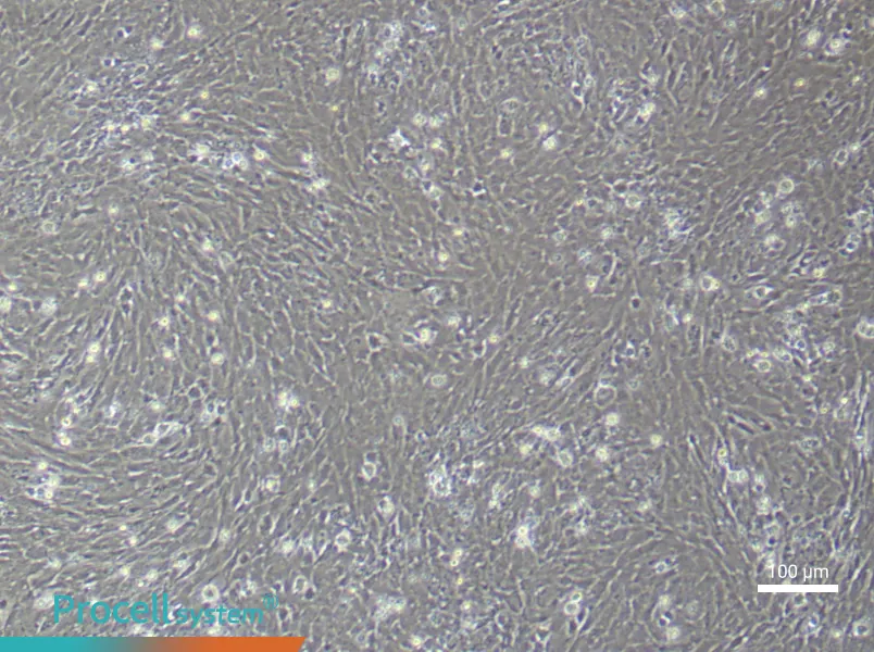 Rat Uterine Smooth Muscle (Primary cell immortalization) Cell Complete MediumRat Uterine Smooth Muscle (Primary cell immortalization) Cell Complete Medium - 1