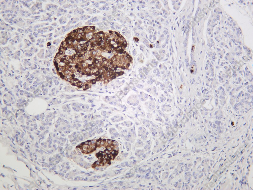 Recombinant Chromogranin A/CHGA/CGA Monoclonal Antibody - 3