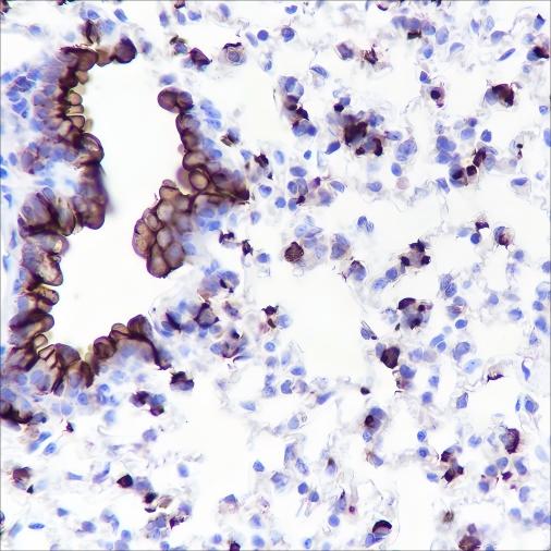 Recombinant MUC1 Monoclonal Antibody - 3