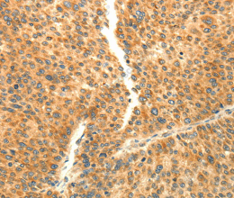 AARS2 Polyclonal Antibody - 3