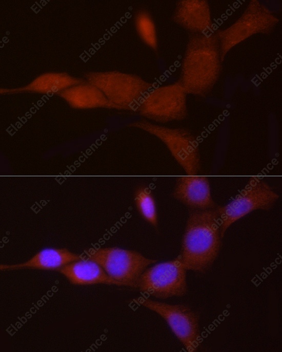 PGC1 alpha Polyclonal Antibody - 5
