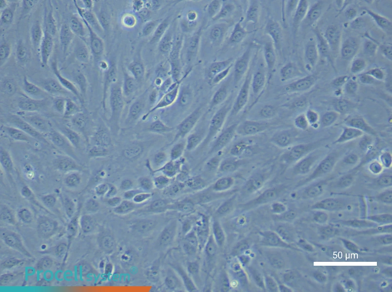 Human Endometrial Epithelial Cell Complete Medium - small - 5