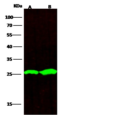 Recombinant UCHL1 Monoclonal Antibody-searchlist-1