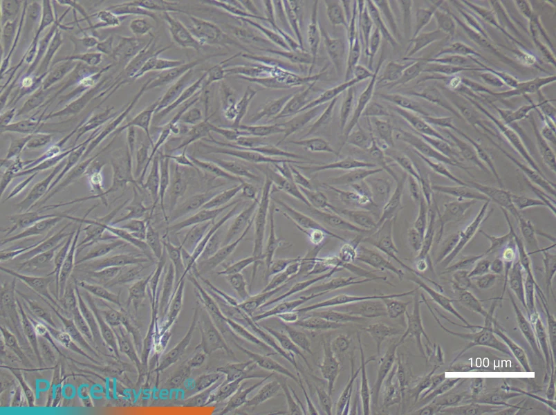 Human Synovial Fibroblast Complete Medium - 3