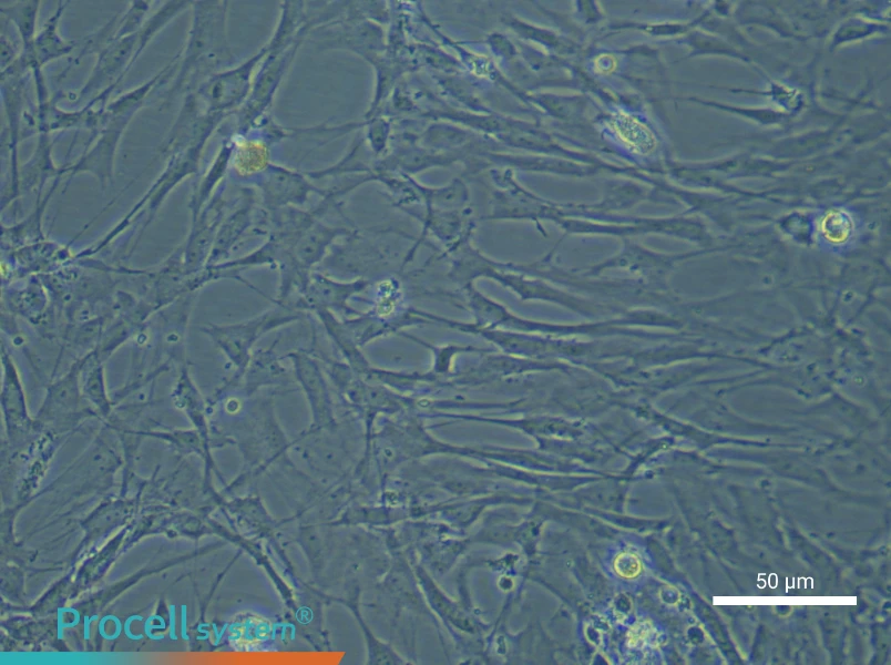 Rat Brain Fibroblast Complete Medium - 6
